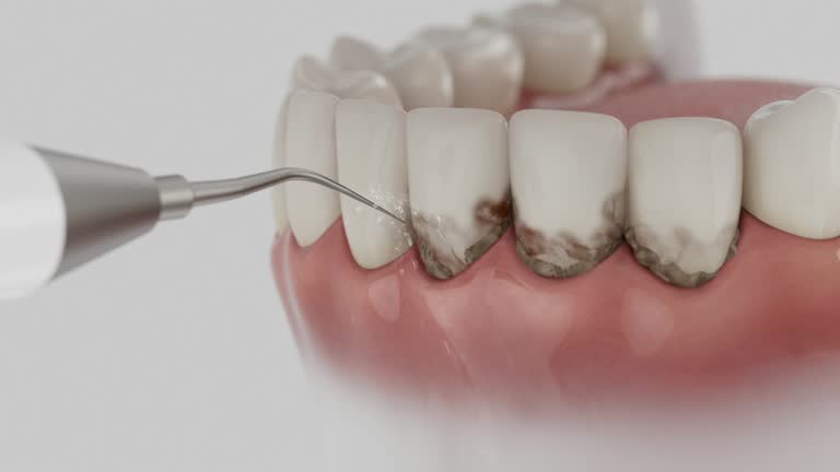 Reliable Dental Crowns And Bridges contractor in Miller County County, GA by Dentist Open Now